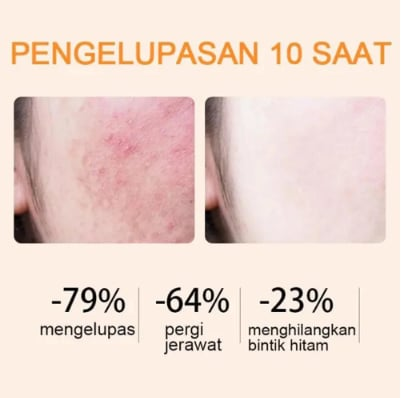 🔥Orange Enzyme Exfoliating Gel — Deep Clean, Brighten & Hydrate – All in One Natural Gel