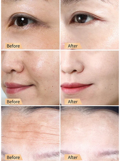 Snail Hydrating Anti-Wrinkle and Rejuvenating Cream