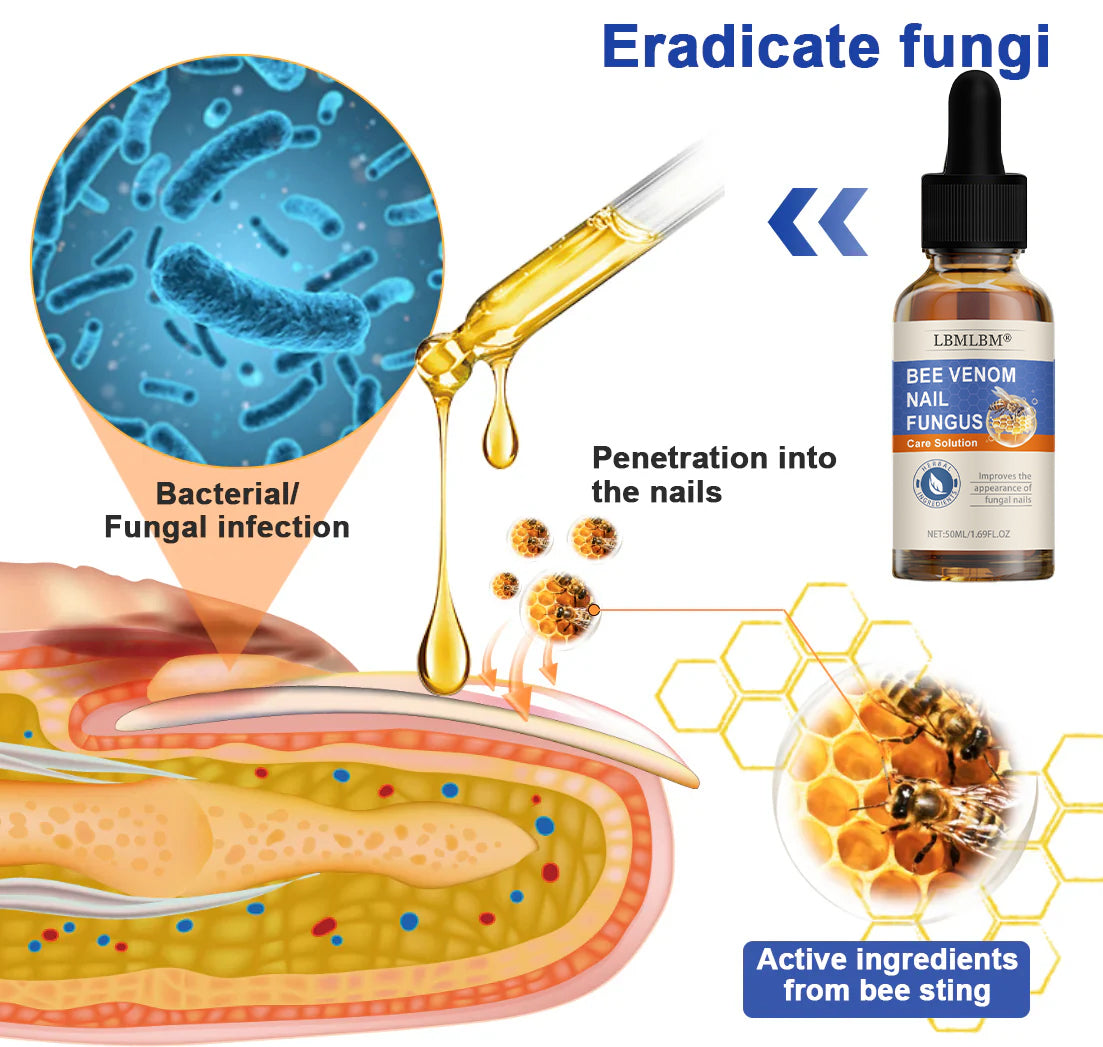 🐝🐝 LBMLBM™  Bee Venom Nail Fungus Treatment Solution: A Complete Solution to Nail Fungus🌟👣