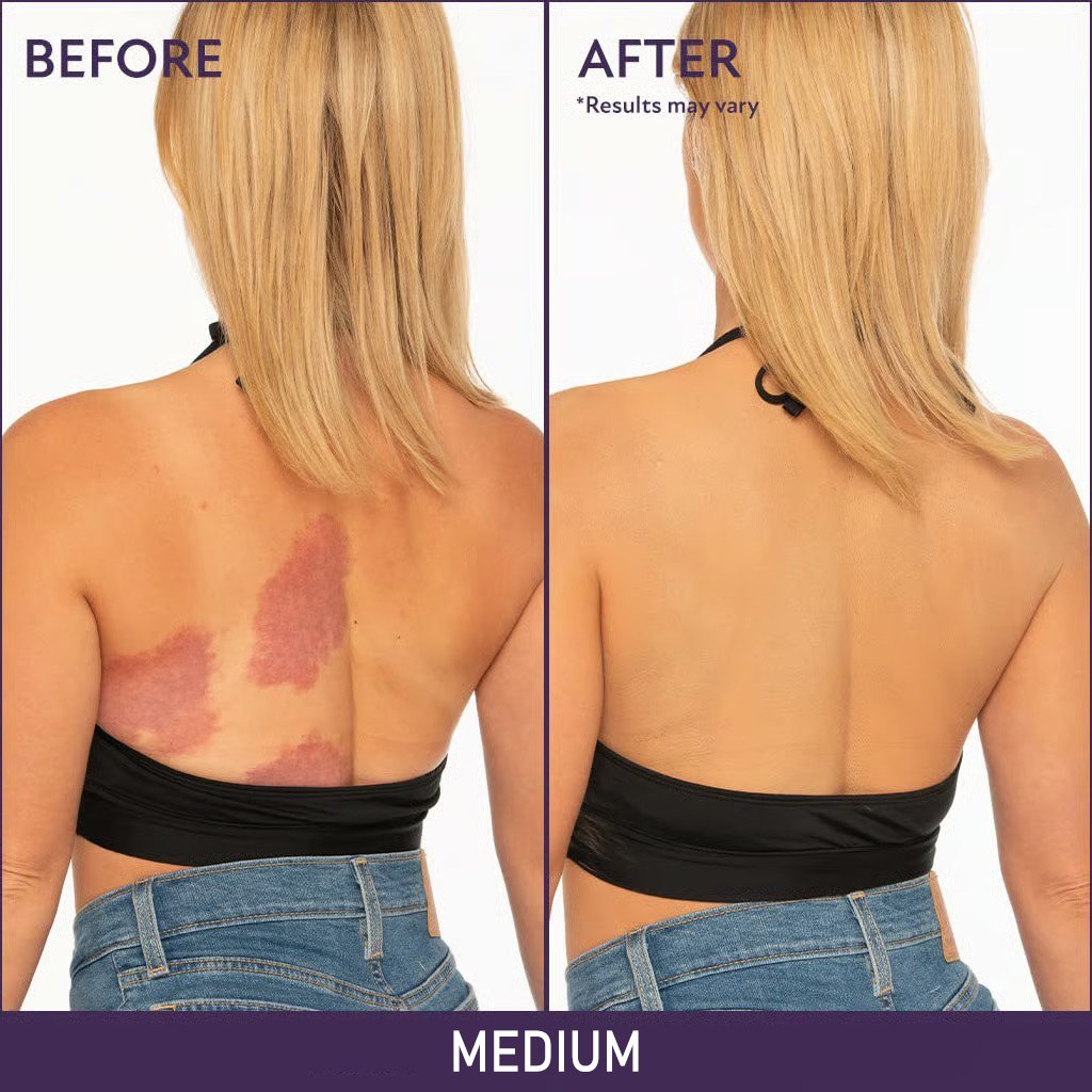 🔥Final 3 Hours: 70% OFF-3-in-1 Concealer: (Hydrates, Covers, and Color-Corrects) – 12H Waterproof & Smudge-Proof🎁