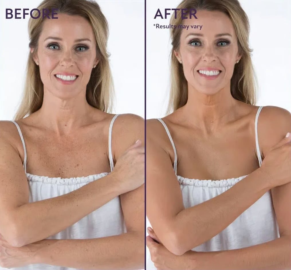 🔥Final 3 Hours: 70% OFF-3-in-1 Concealer: (Hydrates, Covers, and Color-Corrects) – 12H Waterproof & Smudge-Proof🎁