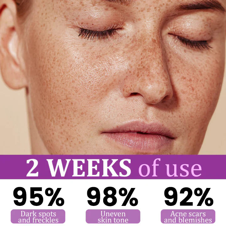 ✨ Advanced Anti-Hyperpigmentation Essence – Fade Dark Spots, Even Skin Tone & Boost Radiance in Just 2 Weeks! 🌟