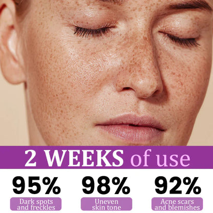 ✨ Advanced Anti-Hyperpigmentation Essence – Fade Dark Spots, Even Skin Tone & Boost Radiance in Just 2 Weeks! 🌟