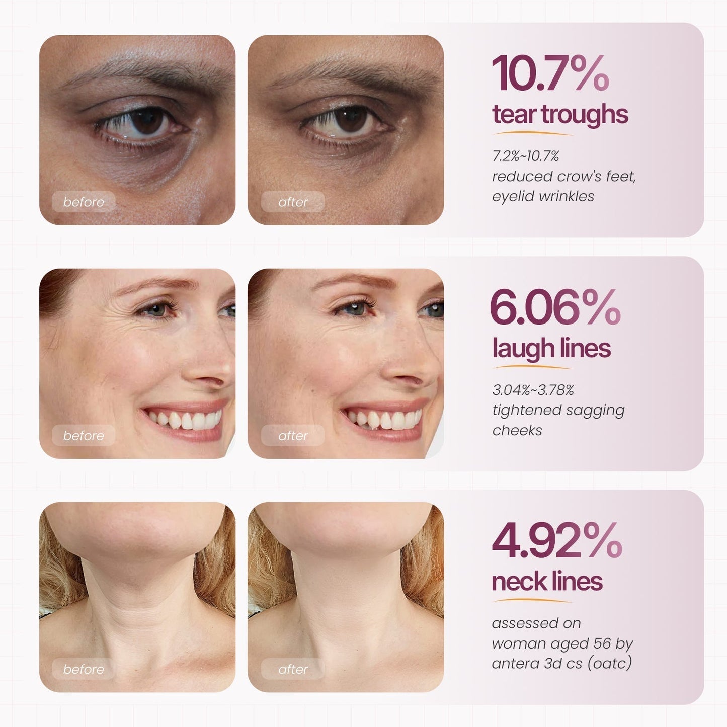 🏆Limited Time Offer🏆 — Calcium Multi-Effect Moisturizing Cream | Anti-Aging, Firming, Wrinkle Removal🔥