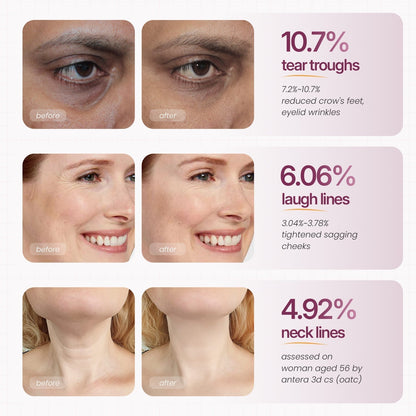 🏆Limited Time Offer🏆 — Calcium Multi-Effect Moisturizing Cream | Anti-Aging, Firming, Wrinkle Removal🔥