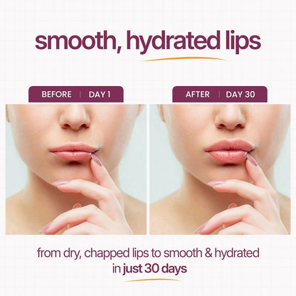 🏆Limited Time Offer🏆 — Calcium Multi-Effect Moisturizing Cream | Anti-Aging, Firming, Wrinkle Removal🔥