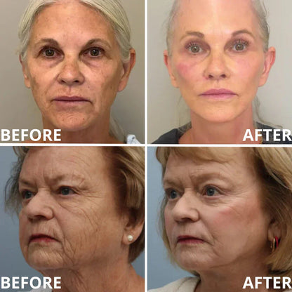 🏆Limited Time Offer🏆—JEREMYTIS™ Calcium Multi-Effect Eye Cream💫 Anti-Aging Firming Eye Treatment Bar🔥