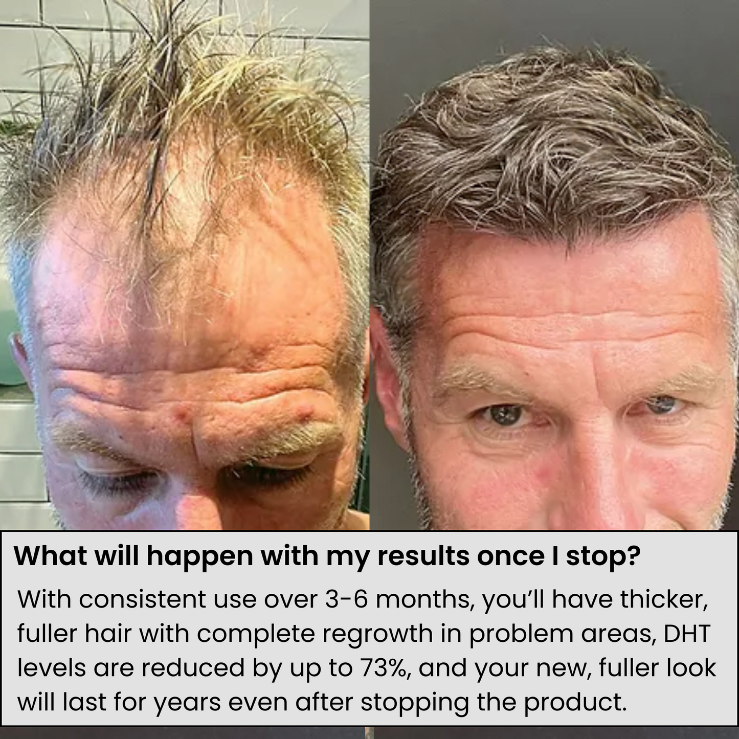 ODALIT™ Hair Regrowth System | Real Results for Thicker, Fuller Hair—Clinically Backed Serum That Works