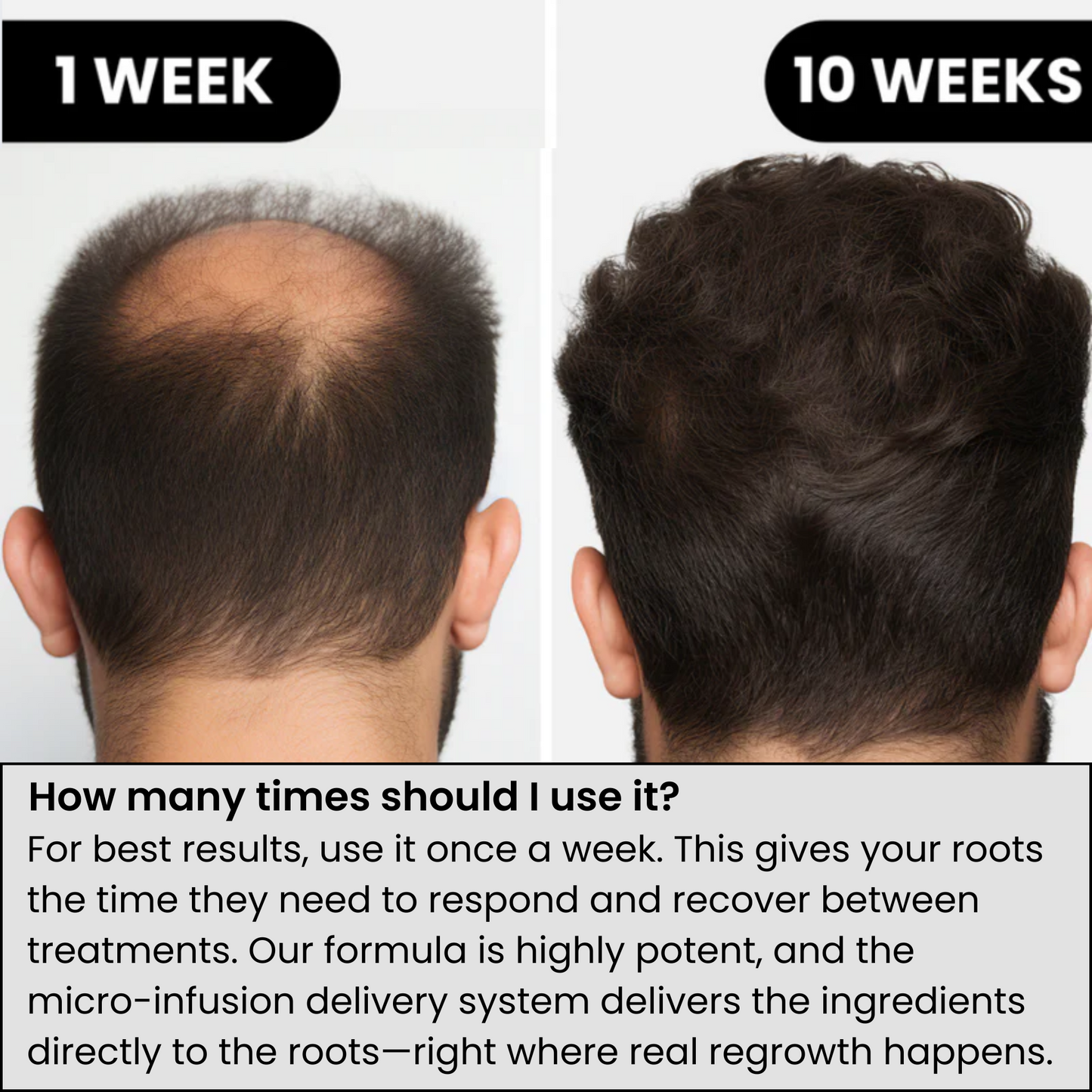 ODALIT™ Hair Regrowth System | Real Results for Thicker, Fuller Hair—Clinically Backed Serum That Works