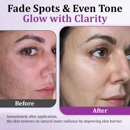✨ Advanced Anti-Hyperpigmentation Essence – Fade Dark Spots, Even Skin Tone & Boost Radiance in Just 2 Weeks! 🌟